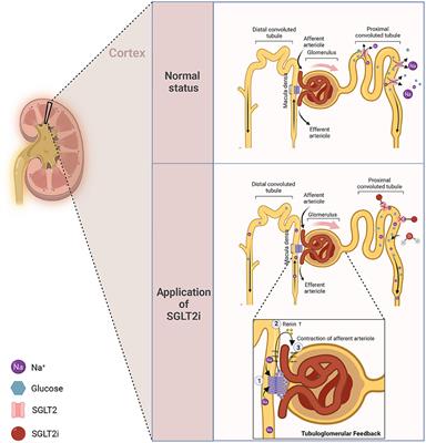 New insights and advances of sodium-glucose cotransporter 2 inhibitors in heart failure